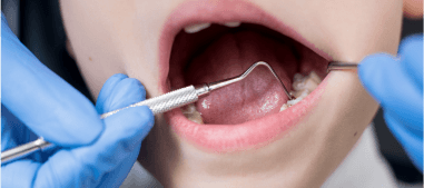 teeth being reviewed