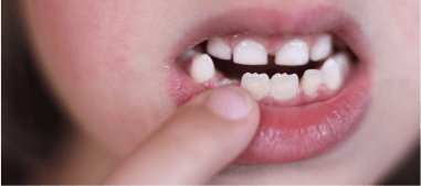 pointing at a missing tooth